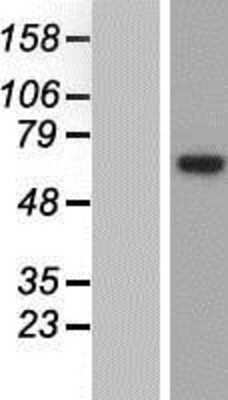 Western Blot: EEF1D Overexpression Lysate (Adult Normal) [NBP2-09501] Left-Empty vector transfected control cell lysate (HEK293 cell lysate); Right -Over-expression Lysate for EEF1D.