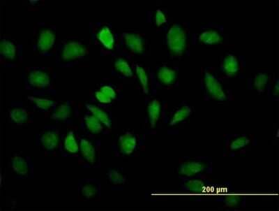 Immunocytochemistry/Immunofluorescence: EEF1E1 Antibody [H00009521-B01P] - Analysis of purified antibody to EEF1E1 on HeLa cell. (antibody concentration 10 ug/ml)