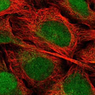 Immunocytochemistry/Immunofluorescence: EEF1E1 Antibody [NBP2-55640] - Staining of human cell line U-2 OS shows localization to nucleus & cytosol.