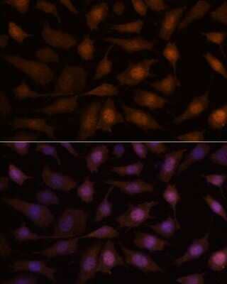 Immunocytochemistry/Immunofluorescence: EEF1E1 Antibody [NBP2-92227] - Analysis of L929 cells using EEF1E1 at dilution of 1:100. Blue: DAPI for nuclear staining.