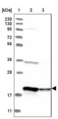 Western Blot: EEF1E1 Antibody [NBP1-89186] - Lane 1: Marker  [kDa] 230, 130, 95, 72, 56, 36, 28, 17, 11.  Lane 2: Human cell line RT-4.  Lane 3: Human cell line U-251MG