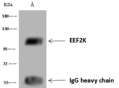 Immunoprecipitation: EEF2K Antibody [NBP3-12694] - Lane A:0.5 mg HeLa Whole Cell Lysate4 uL anti-EEF2K rabbit polyclonal antibody and 60 ug of Immunomagnetic beads Protein A/G.Primary antibody:Anti-EEF2K rabbit polyclonal antibody,at 1:100 dilution Secondary antibody:Goat Anti-Rabbit IgG (H+L)/HRP at 1/10000 dilutionDeveloped using the ECL technique.Performed under reducing conditions.Predicted band size: 82 kDaObserved band size :100 kDa