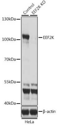 <b>Genetic Strategies Validation. </b>Knockout Validated: EEF2K Antibody [NBP2-92950] - Analysis of extracts from normal (control) and EEF2K knockout (KO) HeLa cells, using EEF2K antibody at 1:1000 dilution. Secondary antibody: HRP Goat Anti-Rabbit IgG (H+L) at 1:10000 dilution. Lysates/proteins: 25ug per lane. Blocking buffer: 3% nonfat dry milk in TBST. Detection:Basic ECL Kit