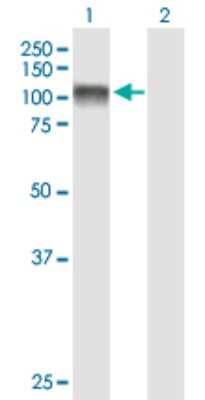 Western Blot: EEF2K Antibody [H00029904-B01P] - Analysis of EEF2K expression in transfected 293T cell line by EEF2K polyclonal antibody.  Lane 1: EEF2K transfected lysate(79.75 KDa). Lane 2: Non-transfected lysate.