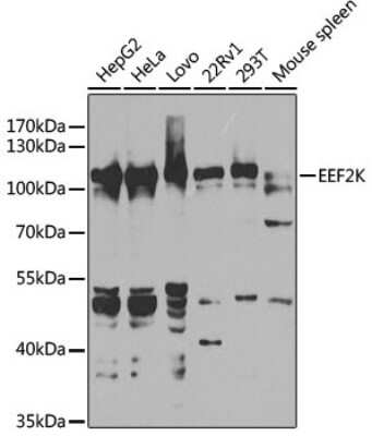 Western Blot: EEF2K Antibody [NBP3-03721] - Western blot analysis of extracts of various cell lines, using EEF2K antibody (NBP3-03721) at 1:1000 dilution. Secondary antibody: HRP Goat Anti-Rabbit IgG (H+L) at 1:10000 dilution. Lysates/proteins: 25ug per lane. Blocking buffer: 3% nonfat dry milk in TBST. Detection: ECL Basic Kit. Exposure time: 40s.