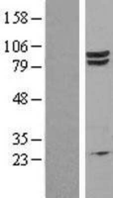 Western Blot EEF2K Overexpression Lysate