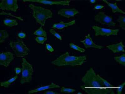 Immunocytochemistry/Immunofluorescence: EEN Antibody (2E8-H5) [H00006455-M01] - Analysis of monoclonal antibody to SH3GL1 on HeLa cell . Antibody concentration 10 ug/ml.
