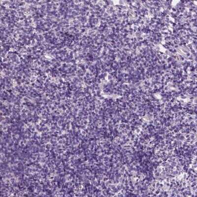 Immunohistochemistry-Paraffin: EFCAB1 Antibody [NBP1-82313] - Staining of human tonsil shows no positivity in lymphoid cells as expected.