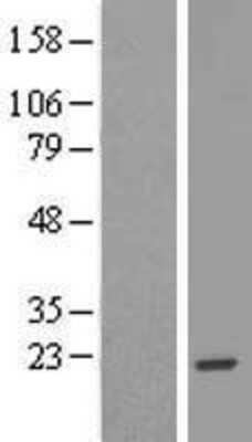 Western Blot: EFCAB11 Overexpression Lysate (Adult Normal) [NBL1-08177] Left-Empty vector transfected control cell lysate (HEK293 cell lysate); Right -Over-expression Lysate for EFCAB11.