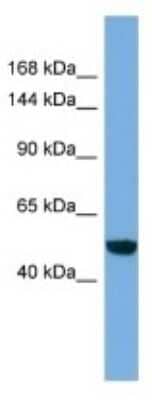 Western Blot: EFCAB13 Antibody [NBP3-10621] - Western blot analysis of EFCAB13 in HT1080 Whole Cell lysates. Antibody dilution at 1.0ug/ml