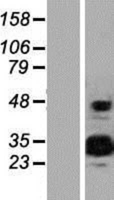 Western Blot EFCAB2 Overexpression Lysate