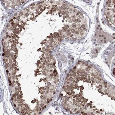 Immunohistochemistry: EFCAB3 Antibody [NBP2-48861] - Staining of human testis shows cytoplasmic and nuclear positivity in cells in seminiferous ducts.