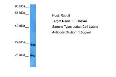 Western Blot: EFCAB4A Antibody [NBP2-87330] - Host: Rabbit. Target Name: EFCAB4A. Sample Tissue: Human Jurkat Whole Cell lysates. Antibody Dilution: 1ug/ml