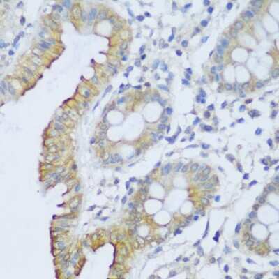 Immunohistochemistry-Paraffin: EFCAB4B Antibody [NBP2-92725] - Paraffin-embedded human colon using EFCAB4B .