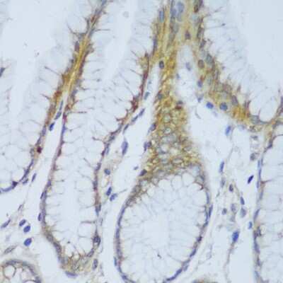 Immunohistochemistry-Paraffin: EFCAB4B Antibody [NBP2-92725] - Paraffin-embedded human stomach using EFCAB4B .
