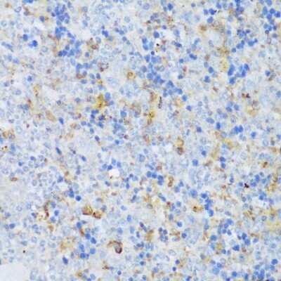Immunohistochemistry-Paraffin: EFCAB4B Antibody [NBP2-92725] - Paraffin-embedded mouse spleen using EFCAB4B .