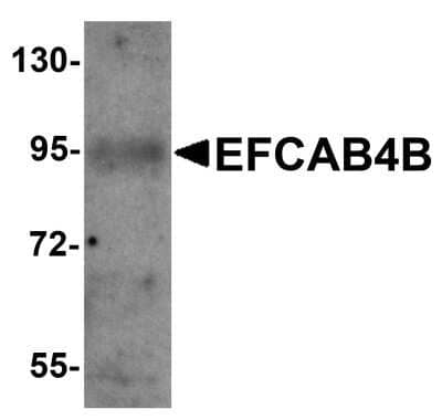 Western Blot: EFCAB4B Antibody [NBP1-76493] - mouse kidney tissue lysate with EFCAB4B antibody at 1 ug/mL.