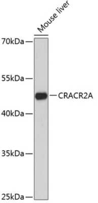 Western Blot: EFCAB4B Antibody [NBP2-92725] - Analysis of extracts of mouse liver, using EFCAB4B at 1:3000 dilution.Secondary antibody: HRP Goat Anti-Rabbit IgG (H+L) at 1:10000 dilution.Lysates/proteins: 25ug per lane.Blocking buffer: 3% nonfat dry milk in TBST.Detection: ECL Basic Kit .Exposure time: 90s.