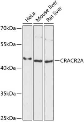 Western Blot: EFCAB4B Antibody [NBP2-92726] - Analysis of extracts of various cell lines, using EFCAB4B at 1:3000 dilution.Secondary antibody: HRP Goat Anti-Rabbit IgG (H+L) at 1:10000 dilution.Lysates/proteins: 25ug per lane.Blocking buffer: 3% nonfat dry milk in TBST.Detection: ECL Basic Kit .Exposure time: 90s.