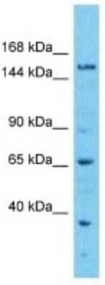 Western Blot: EFCAB5 Antibody [NBP3-10768] - Western blot analysis of EFCAB5 in ACHN Whole cell lysates. Antibody dilution at 1.0ug/ml