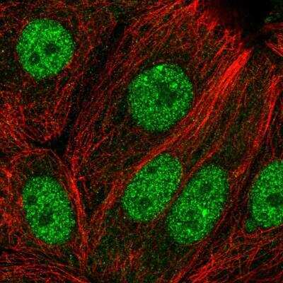 Immunocytochemistry/Immunofluorescence: EFCAB6 Antibody [NBP1-84237] - Staining of human cell line MCF7 shows localization to nucleoplasm. Antibody staining is shown in green.