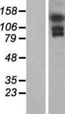 Western Blot: EFCAB6 Overexpression Lysate (Adult Normal) [NBP2-04672] Left-Empty vector transfected control cell lysate (HEK293 cell lysate); Right -Over-expression Lysate for EFCAB6.