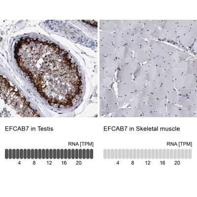 <b>Orthogonal Strategies Validation. </b>Immunohistochemistry-Paraffin: EFCAB7 Antibody [NBP1-81373] - Staining in human testis and skeletal muscle tissues using anti-EFCAB7 antibody. Corresponding EFCAB7 RNA-seq data are presented for the same tissues.