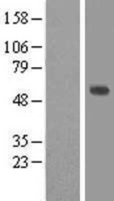 Western Blot: EFEMP1 Overexpression Lysate (Adult Normal) [NBP2-07911] Left-Empty vector transfected control cell lysate (HEK293 cell lysate); Right -Over-expression Lysate for EFEMP1.