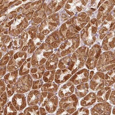 Immunohistochemistry: EFHC1 Antibody [NBP2-38245] - Staining of human stomach, upper shows strong cytoplasmic positivity in glandular cells.