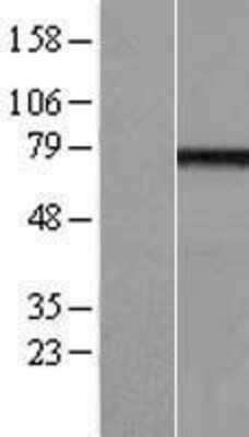 Western Blot: EFHC1 Overexpression Lysate (Adult Normal) [NBL1-10139] Left-Empty vector transfected control cell lysate (HEK293 cell lysate); Right -Over-expression Lysate for EFHC1.