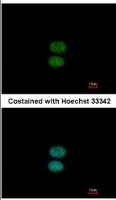 Immunocytochemistry/ Immunofluorescence EFHC2 Antibody