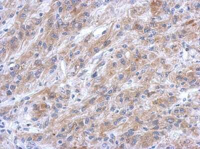 Immunohistochemistry-Paraffin EFHC2 Antibody