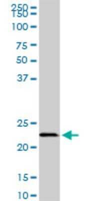Western Blot: EFHD1 Antibody (1F5) [H00080303-M08] - Analysis of EFHD1 expression in NIH/3T3 (Cat # L018V1).