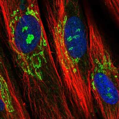 Immunocytochemistry/Immunofluorescence: EFHD1 Antibody [NBP2-33281] - Immunofluorescent staining of human cell line BJ shows localization to nucleoli fibrillar center & the Golgi apparatus.