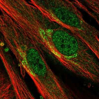 Immunocytochemistry/Immunofluorescence: EFHD1 Antibody [NBP2-33808] - Staining of human cell line BJ shows localization to nucleoplasm & the Golgi apparatus. Antibody staining is shown in green.