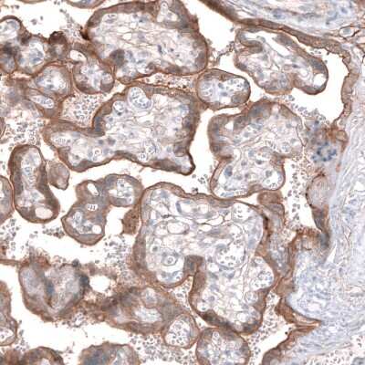 Immunohistochemistry-Paraffin: EFHD1 Antibody [NBP2-33281] - Staining of human placenta shows moderate cytoplasmic positivity in trophoblastic cells.