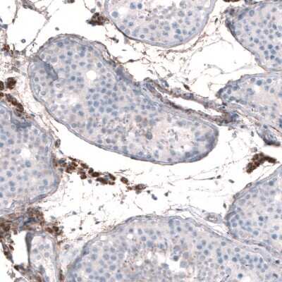 Immunohistochemistry-Paraffin: EFHD1 Antibody [NBP2-33281] - Staining of human testis shows moderate to strong granular cytoplasmic positivity in Leydig cells.