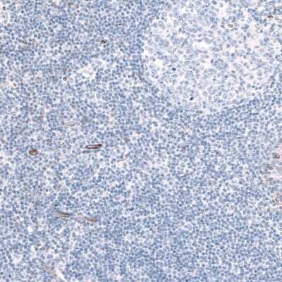 Immunohistochemistry-Paraffin: EFHD1 Antibody [NBP2-33281] - Staining of human tonsil shows no positivity in lymphoid cells as expected.