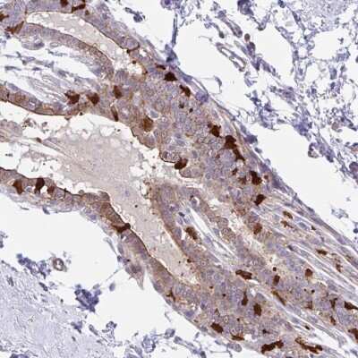 Immunohistochemistry-Paraffin: EFHD1 Antibody [NBP2-33808] - Staining of human breast shows high expression.