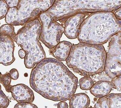 Immunohistochemistry-Paraffin: EFHD1 Antibody [NBP2-33808] - Staining of human placenta shows moderate strong cytoplasmic and membranous positivity in trophoblastic cells.