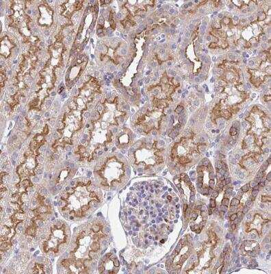 <b>Orthogonal Strategies Validation. </b>Immunohistochemistry-Paraffin: EFHD1 Antibody [NBP2-33808] -  Staining of human kidney shows moderate membranous positivity in cells in tubules.