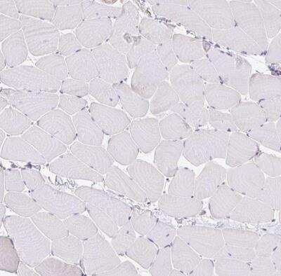 Immunohistochemistry-Paraffin: EFHD1 Antibody [NBP2-33808] - Staining of human skeletal muscle shows no positivity in myocytes as expected.