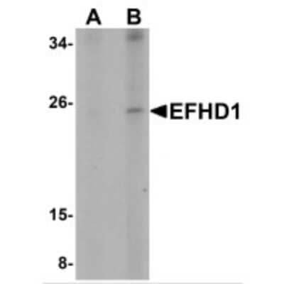 Western Blot: EFHD1 Antibody [NBP1-71995] - Western blot analysis of EFHD1 in human spleen tissue lysate with EFHD1 antibody at (A) 2 and (B) 4 ug/mL.