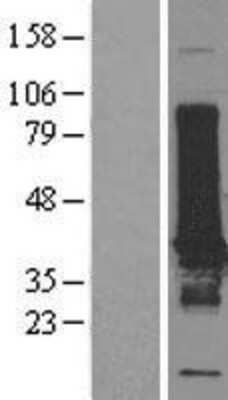 Western Blot: EFHD1 Overexpression Lysate (Adult Normal) [NBL1-10140] Left-Empty vector transfected control cell lysate (HEK293 cell lysate); Right -Over-expression Lysate for EFHD1.