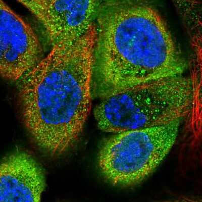 Immunocytochemistry/Immunofluorescence: EFHD2 Antibody [NBP2-13947] - Immunofluorescent staining of human cell line A-431 shows localization to cytosol.