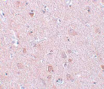 Immunohistochemistry-Paraffin: EFHD2 Antibody [NBP1-77135] - Human brain tissue with EFHD2 antibody at 5 ug/mL.