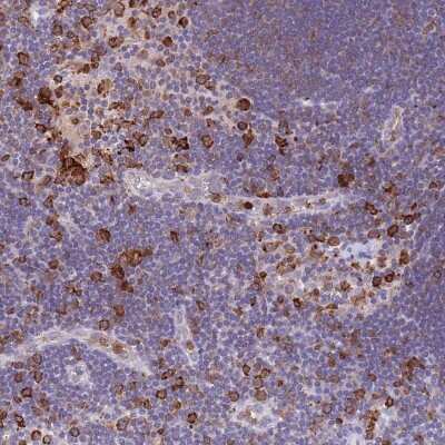 Immunohistochemistry-Paraffin: EFHD2 Antibody [NBP2-13947] - Staining of human lymph node shows strong cytoplasmic positivity in a subset of non-germinal center cells.