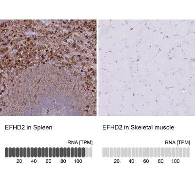 <b>Orthogonal Strategies Validation. </b>Immunohistochemistry-Paraffin: EFHD2 Antibody [NBP2-13947] - Staining in human spleen and skeletal muscle tissues using anti-EFHD2 antibody. Corresponding EFHD2 RNA-seq data are presented for the same tissues.