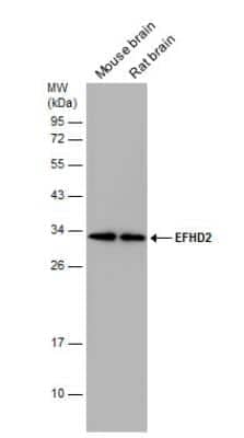 Western Blot: EFHD2 Antibody [NBP1-31134] - Various tissue extracts (50 ug) were separated by 12% SDS-PAGE, and the membrane was blotted with EFHD2 antibody  diluted at 1:1000.