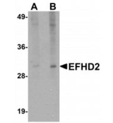 Western Blot: EFHD2 Antibody [NBP1-77135] - Analysis of EFHD2 in mouse brain tissue lysate with EFHD2 antibody at (A) 1 and (B) 2 ug/mL.